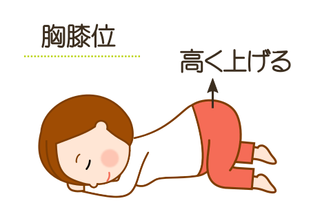 逆子体操１、胸膝位