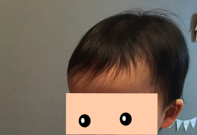 1歳11ヶ月の娘の髪の毛